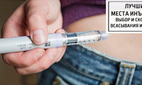 Лучшие места инъекции: выбор и скорость всасывания инсулина